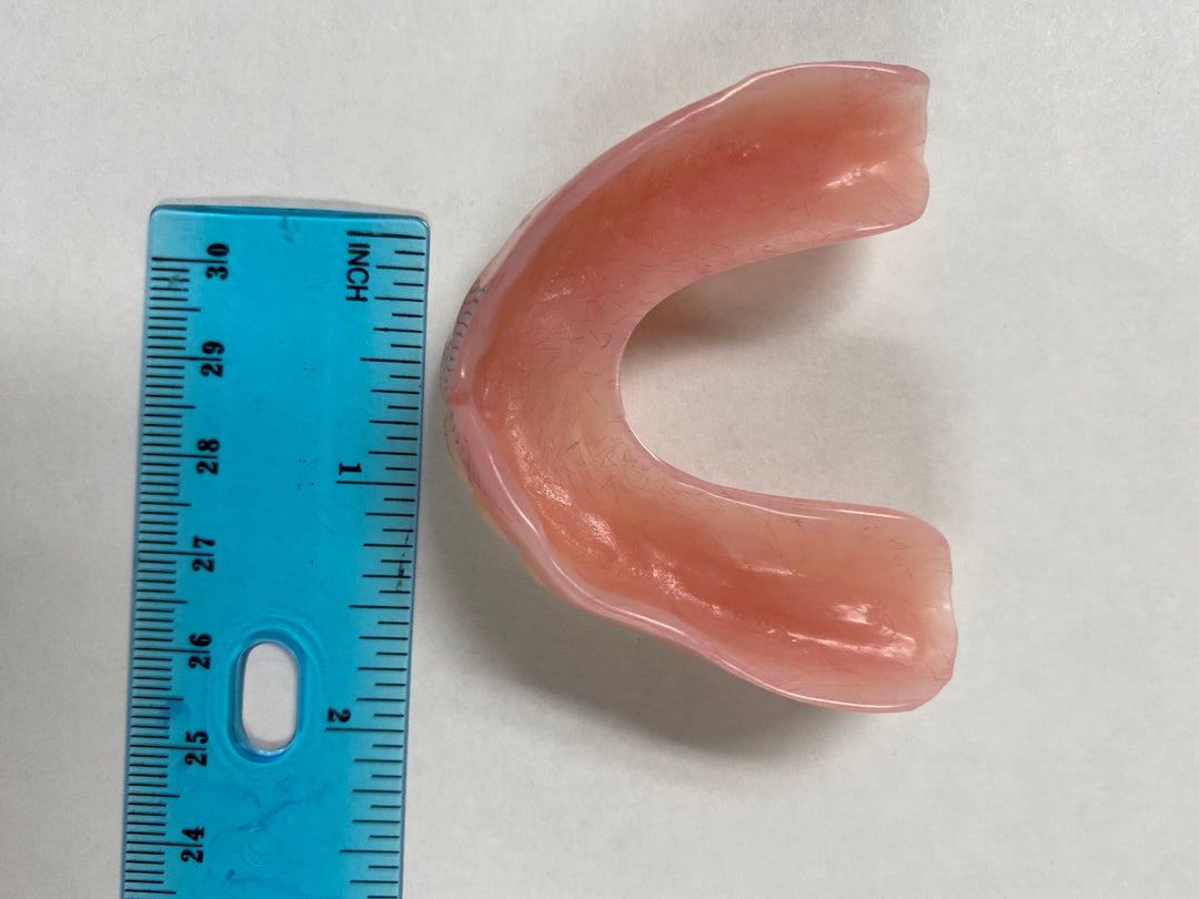 U-Shape Upper Denture – Saldentures