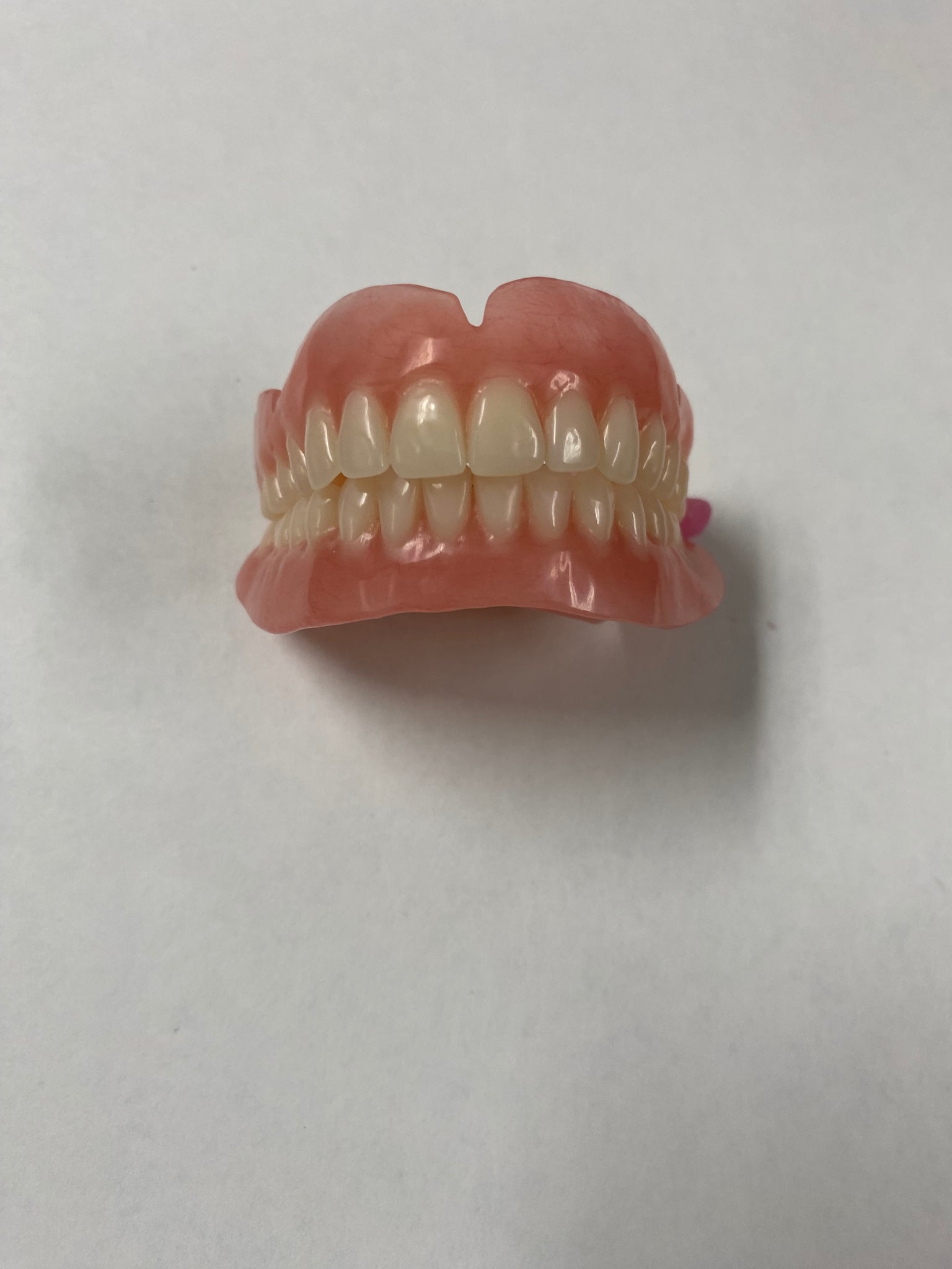 Horseshoe Upper Dentures Without Implantsprivacy
