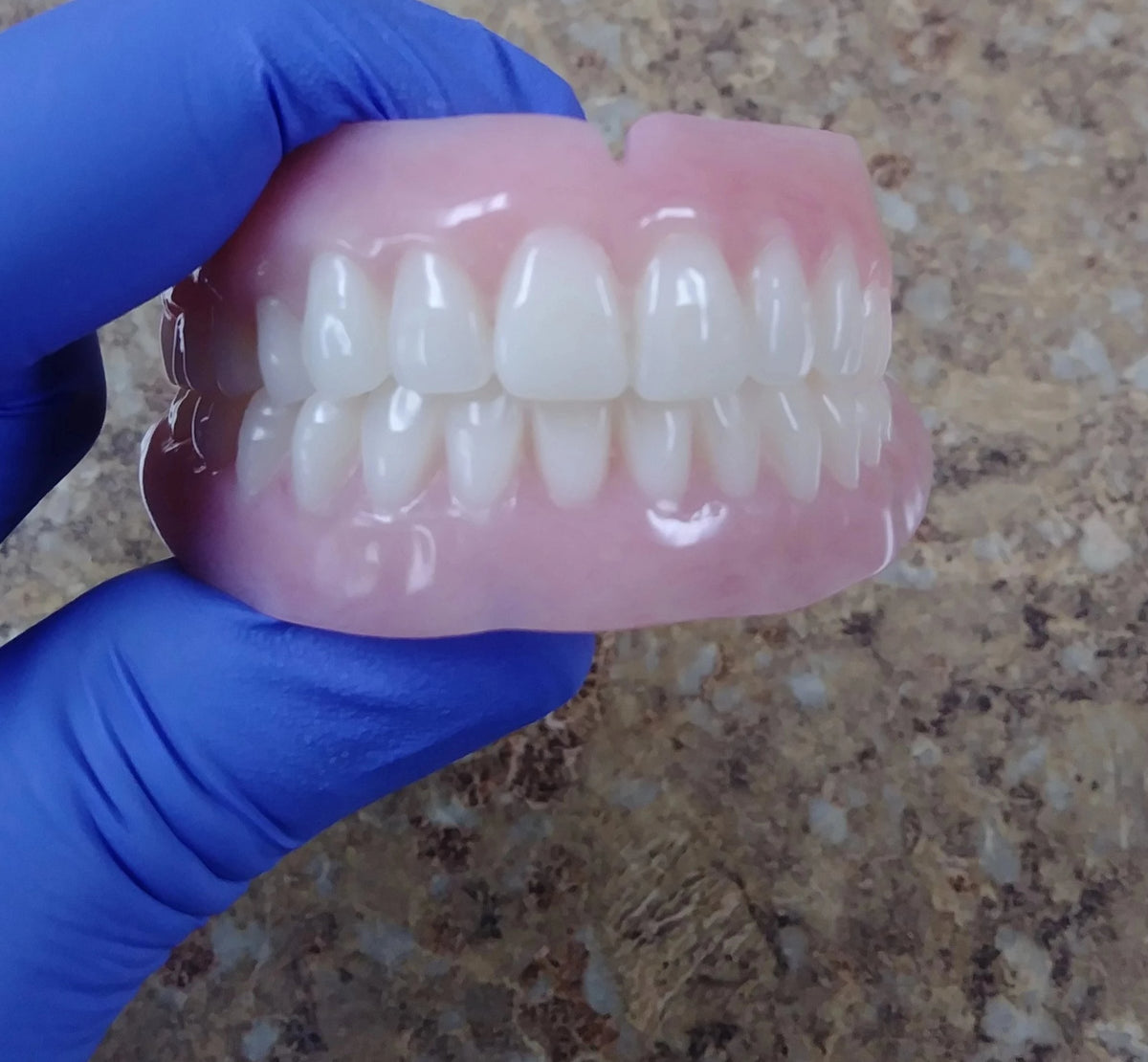 Full Dentures Upper and Lower Set Small - Affordable False Teeth ...