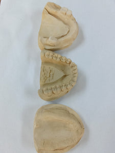 DIY Denture Models, Upper And Lower Lab Stone mold cast/plaster Mold/ dental Study mold Cast