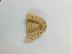 DIY Denture Models, Upper And Lower Lab Stone mold cast/plaster Mold/ dental Study mold Cast