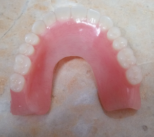 Full Upper U-Shape Denture
