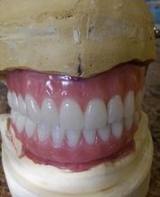 Load image into Gallery viewer, Upper and Lower Denture Custom Made Acrylic False Teeth Denture
