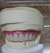 Load image into Gallery viewer, Upper and Lower Denture Custom Made Acrylic False Teeth Denture