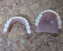 Load image into Gallery viewer, Dentures Full Upper and Lower Dark False Teeth Set Small