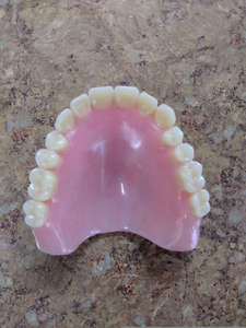 Chipped Denture Repair Custom False Teeth