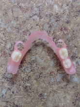 Load image into Gallery viewer, Flexible Upper or Lower Custom Partial False Denture