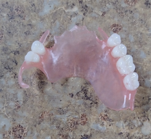 Load image into Gallery viewer, Flexible Upper or Lower Custom Partial False Denture