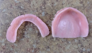 Full Dentures Upper and Lower False Teeth Set Small